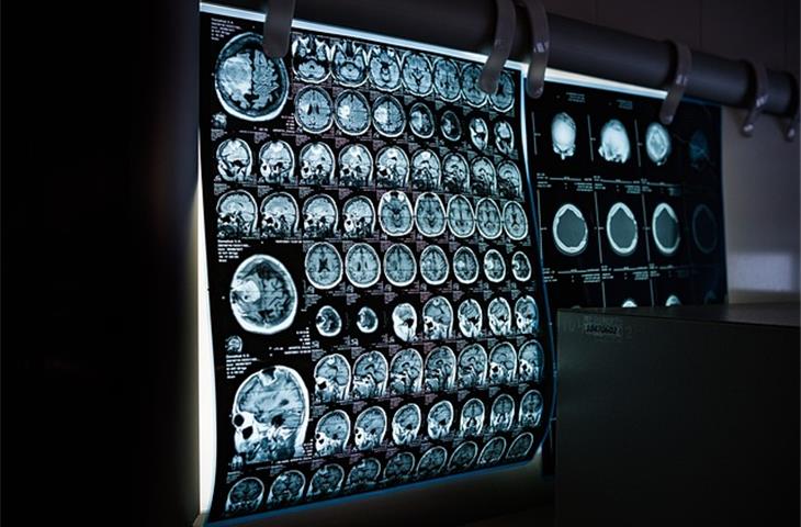 MRI system imaging performance verification system